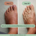 Load image into Gallery viewer, Masseur Thérapeutique Anti-Douleur
