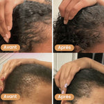 Load image into Gallery viewer, Huile naturelle pour la croissance des cheveux
