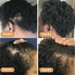 Load image into Gallery viewer, Huile naturelle pour la croissance des cheveux
