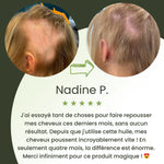 Load image into Gallery viewer, Huile naturelle pour la croissance des cheveux
