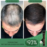 Load image into Gallery viewer, Rouleau de sérum capillaire bio pour la repousse (1+1 gratuit)
