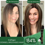 Load image into Gallery viewer, Rouleau de sérum capillaire bio pour la repousse (1+1 gratuit)
